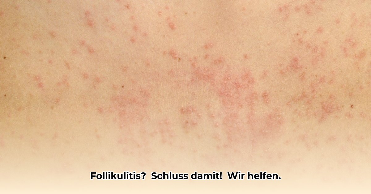 follikulitis